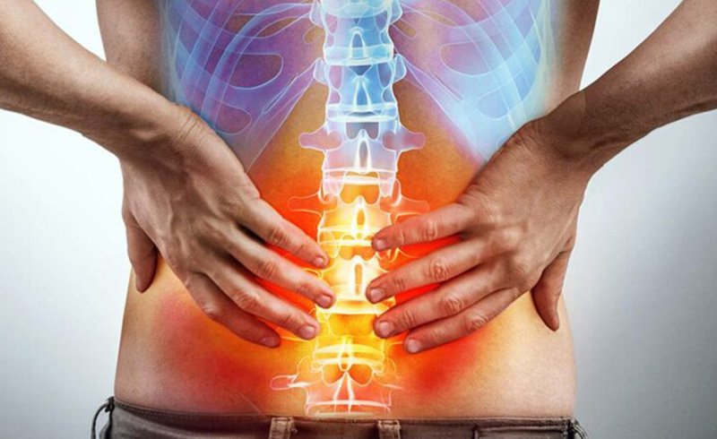 3 consigli per sconfiggere il mal di schiena